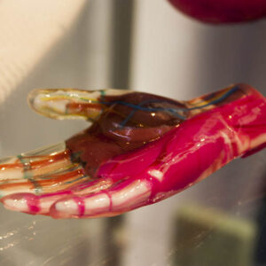 3D printed maltimaterial hand medical application cademix