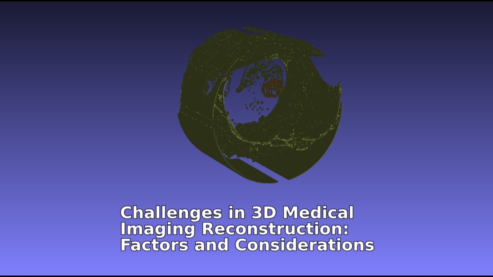 Challenges in 3D Medical Imaging Reconstruction Factors and Considerations Zoe Amin Akhlaghi