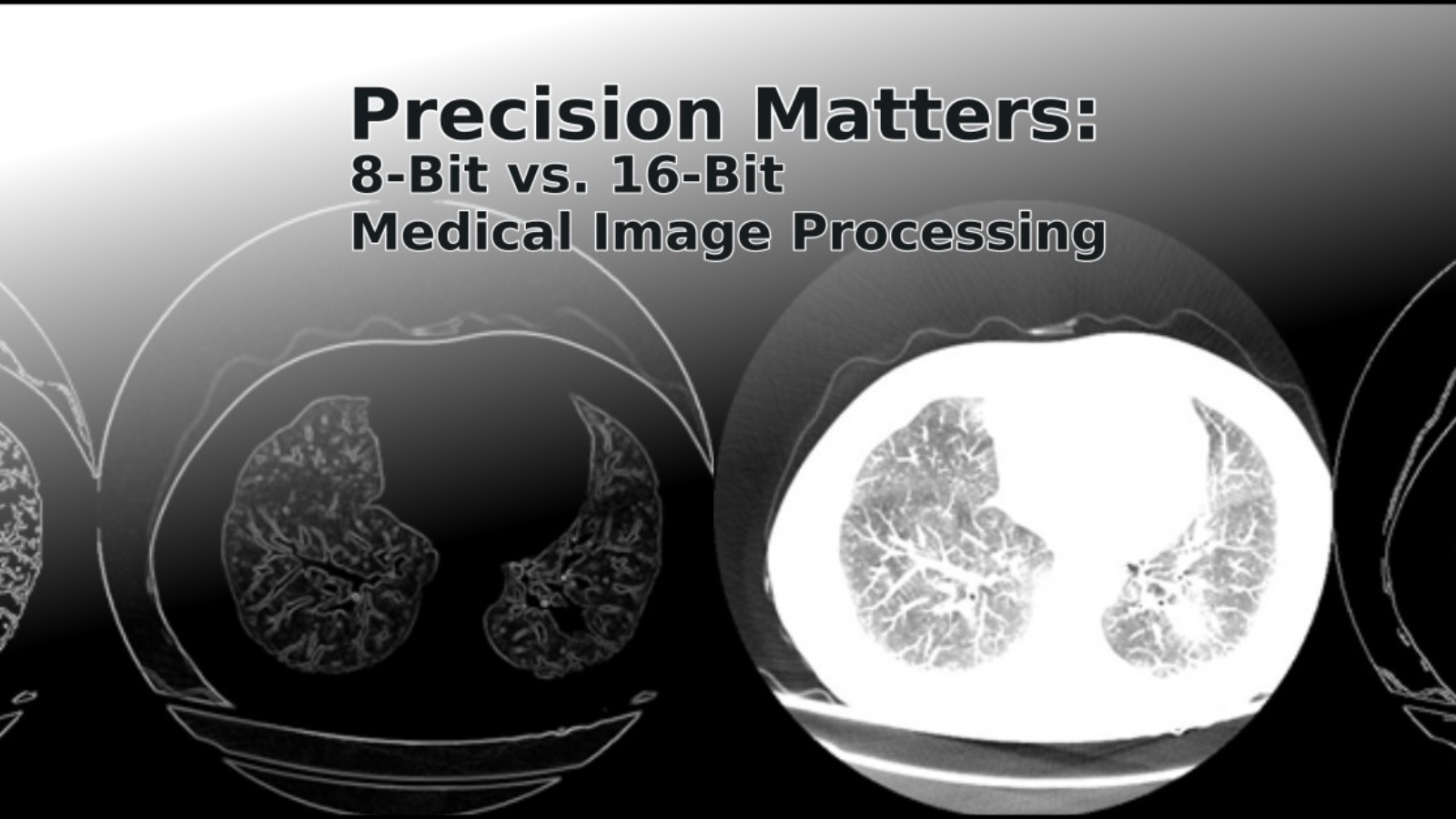 Precision Matters 8-Bit vs. 16-Bit Medical Image Processing Zoe Amin Akhlaghi