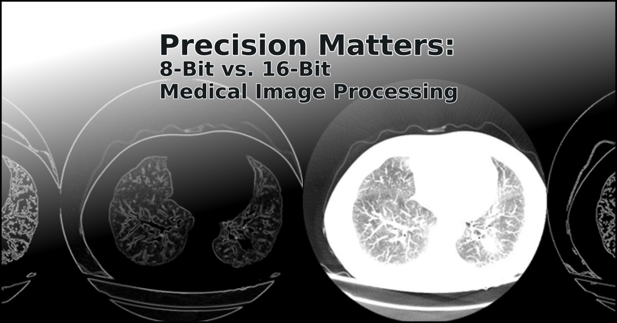 Precision Matters 8-Bit vs. 16-Bit Medical Image Processing Zoe Amin Akhlaghi