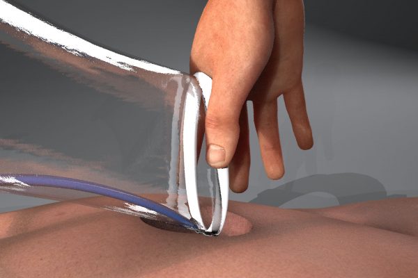 Hand_Medical_Device_800_600 Medical Device Surgery 3D Animation
