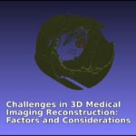 Challenges in 3D Medical Imaging Reconstruction Factors and Considerations Zoe Amin Akhlaghi